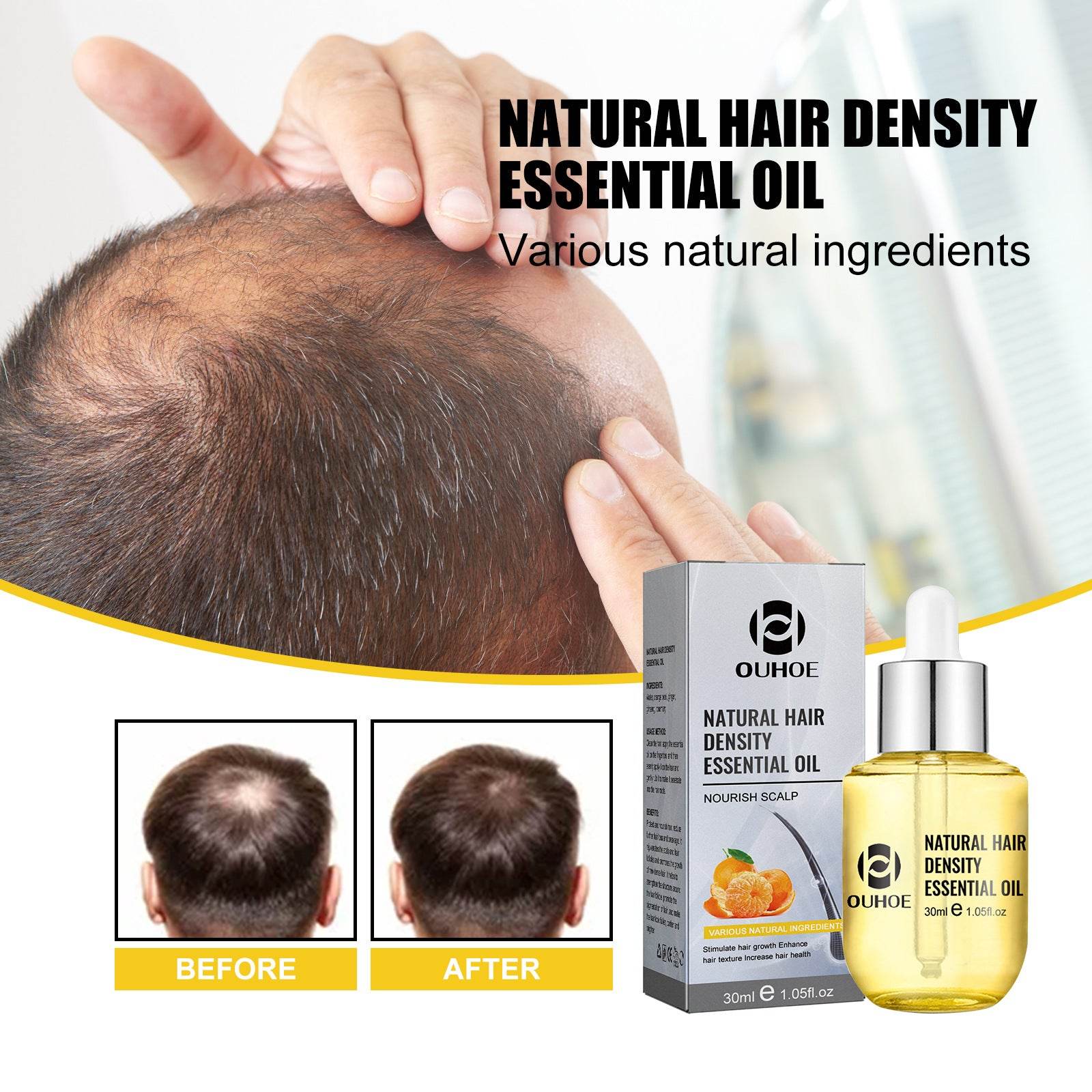 Hair Care Essential Oil Moisturizing And Thick - Mubimart