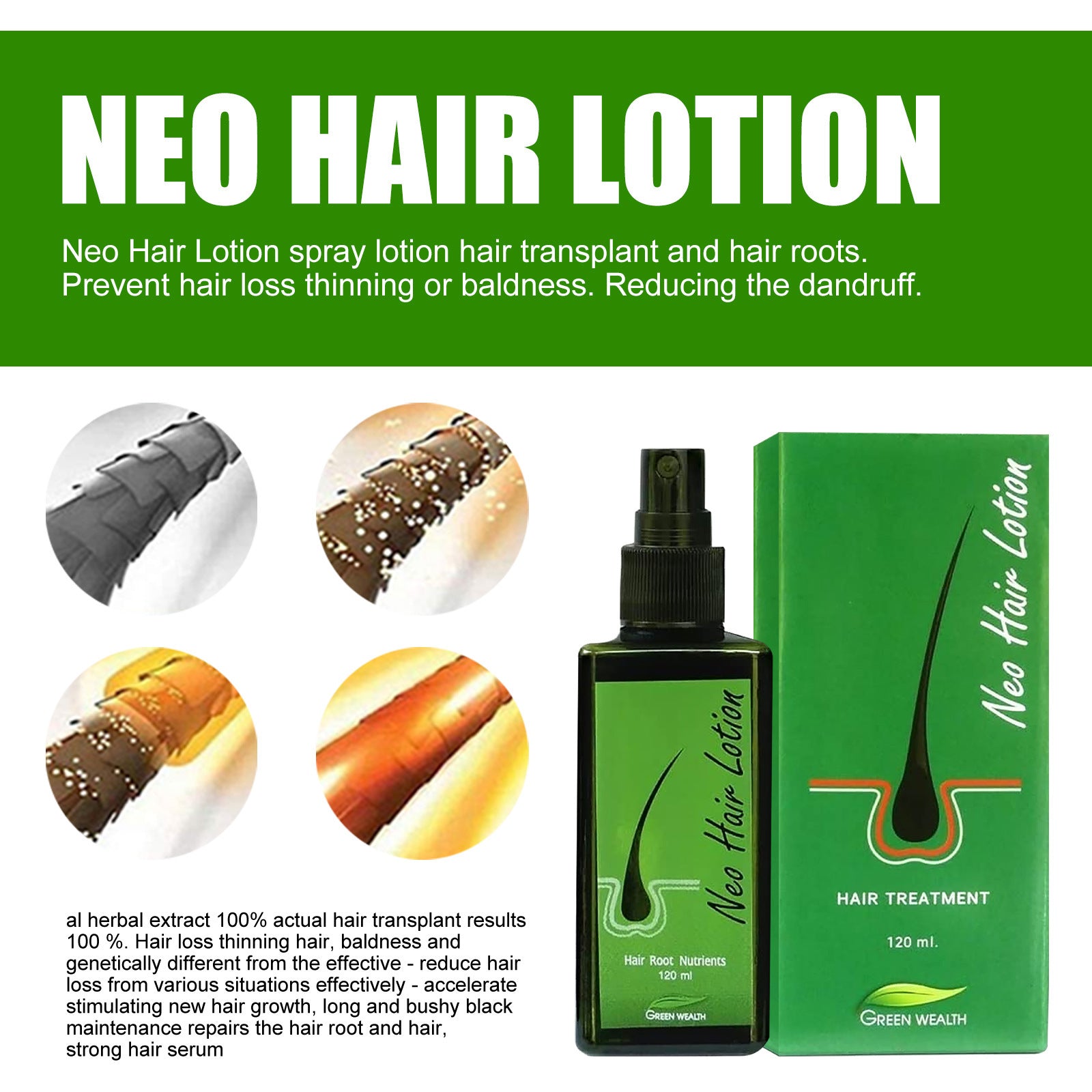 Hair Care Growth Lotion Spray - Mubimart -  