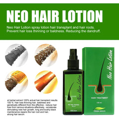 Hair Care Growth Lotion Spray - Mubimart -  