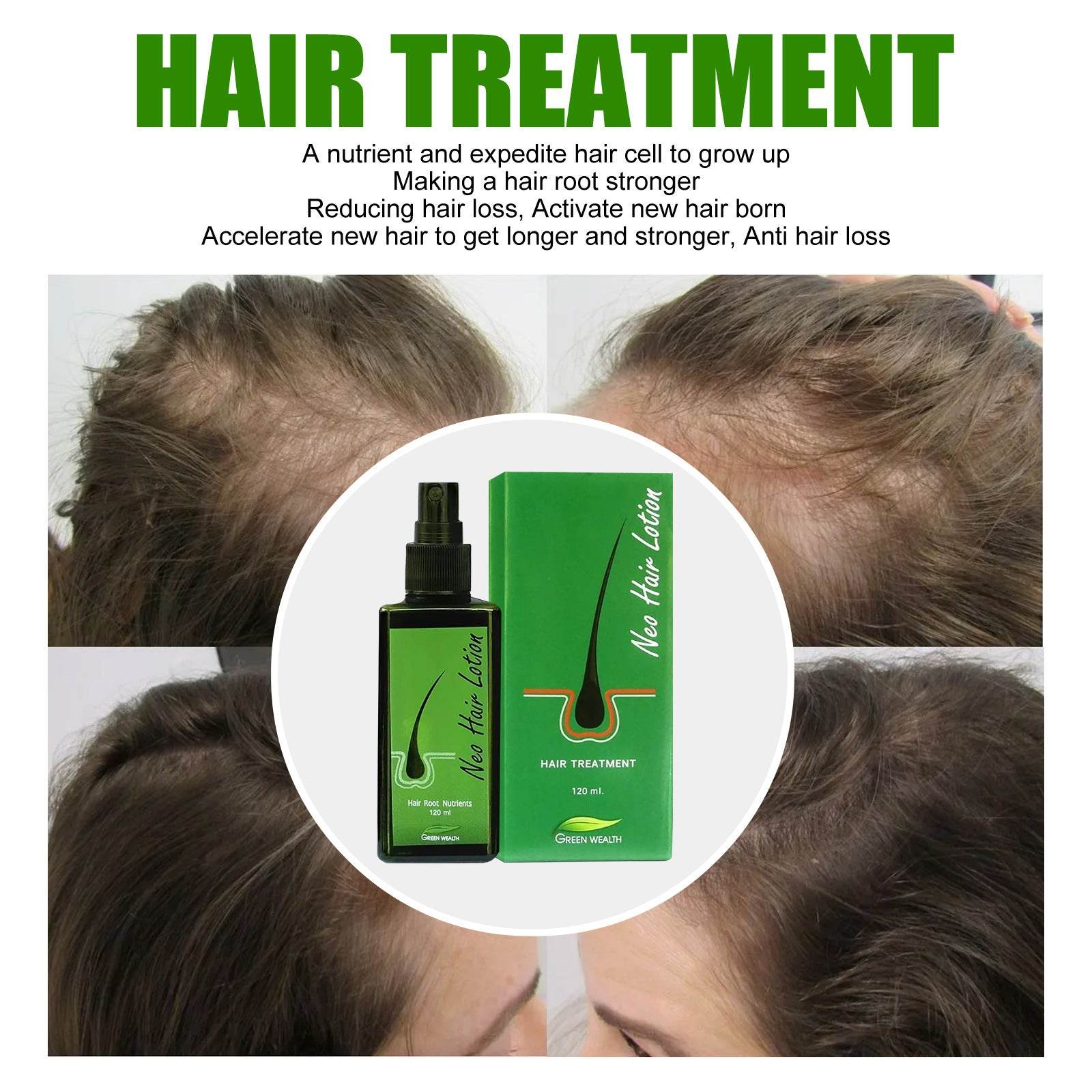 Hair Care Growth Lotion Spray - Mubimart