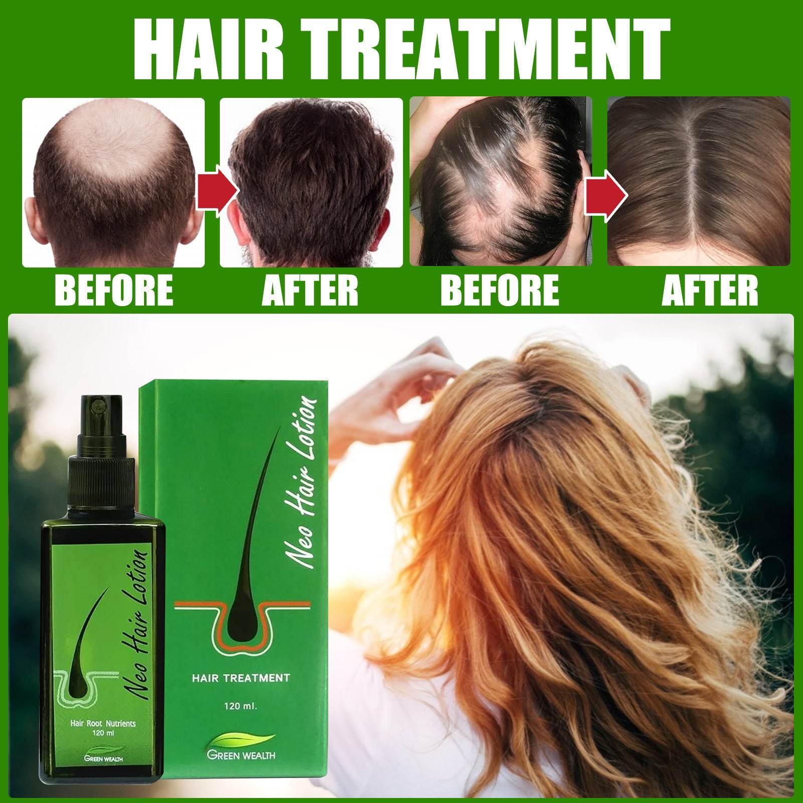 Hair Care Growth Lotion Spray - Mubimart