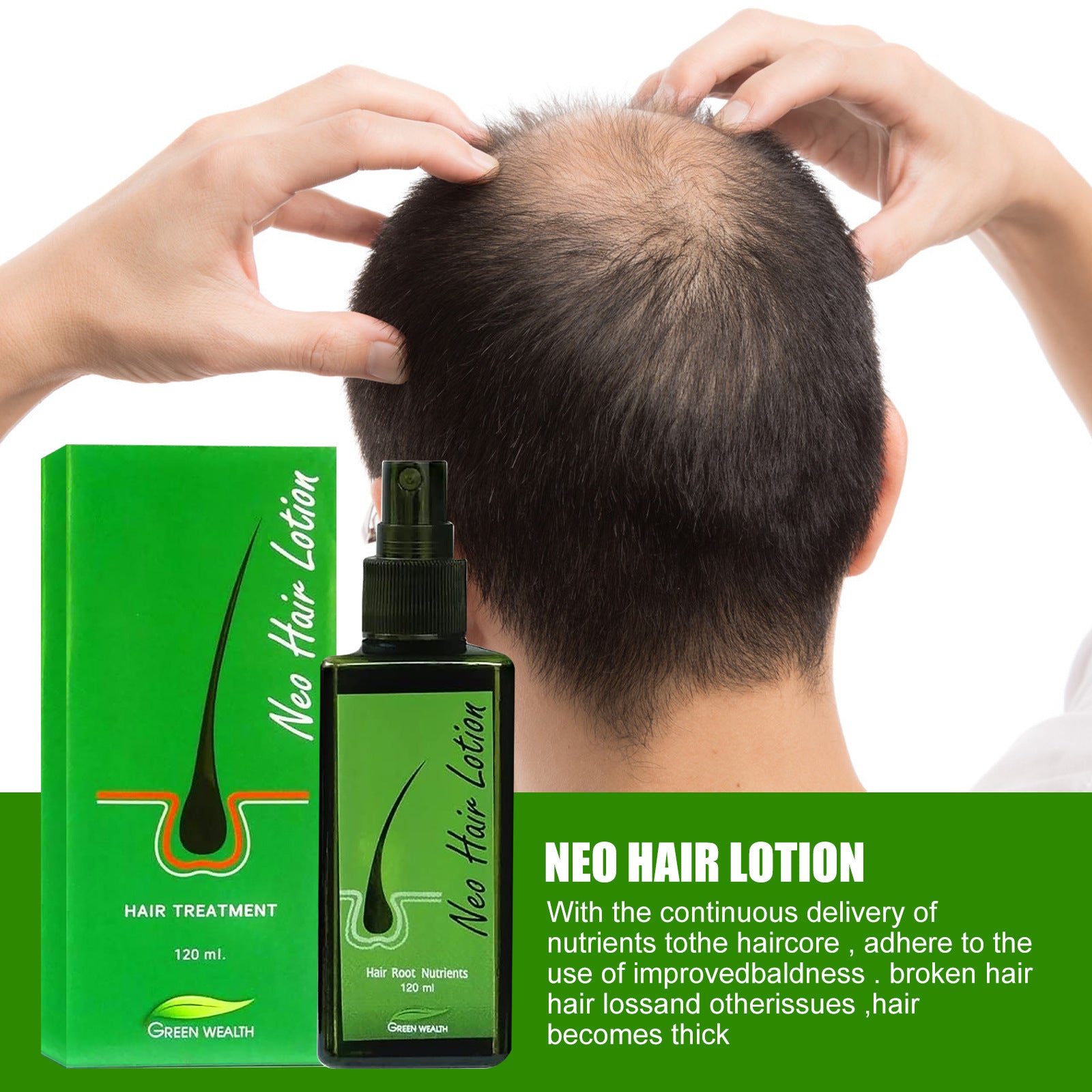 Hair Care Growth Lotion Spray - Mubimart - Hair oil 