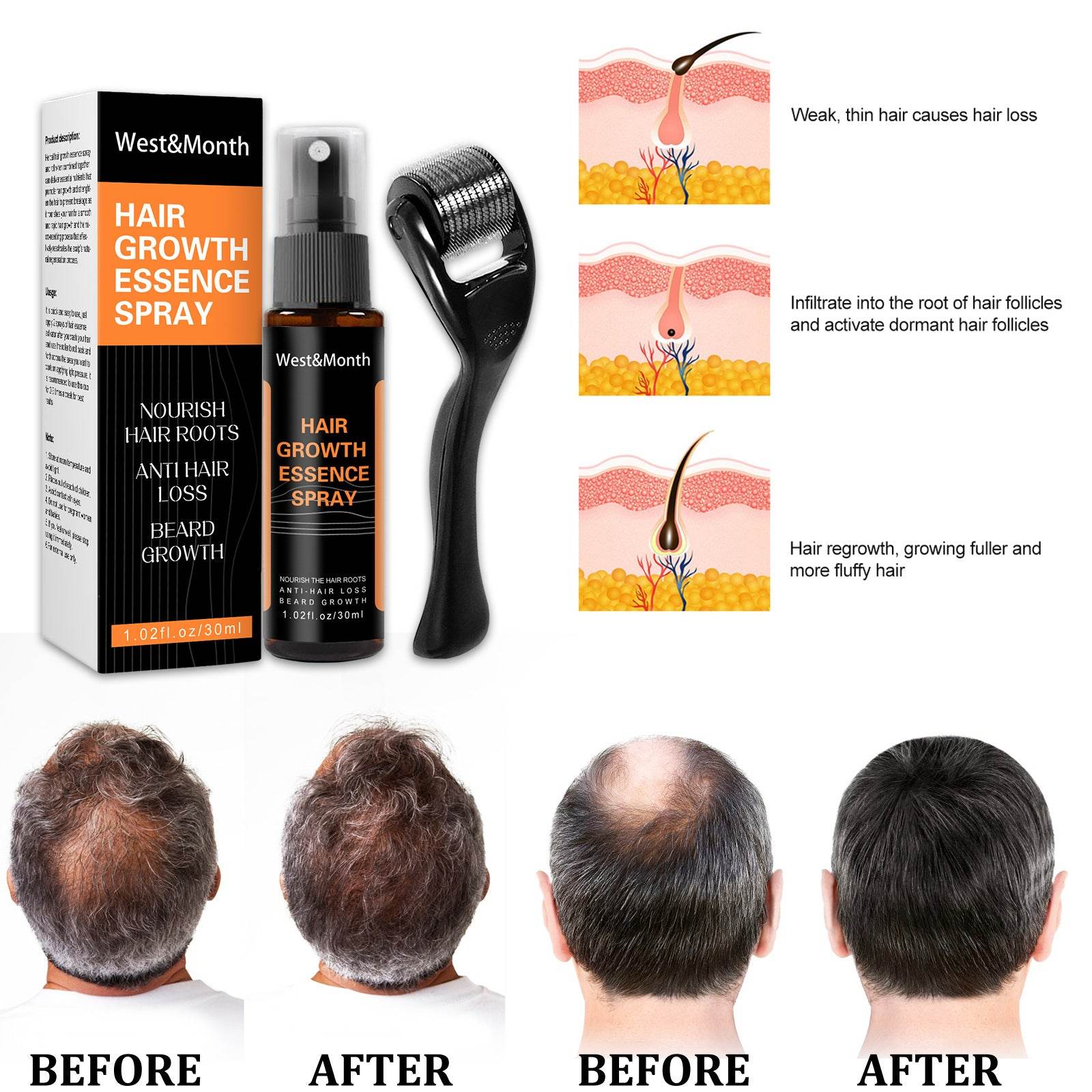 Hair Growth Spray Anti-hair Nourishing Growth Liquid - Mubimart