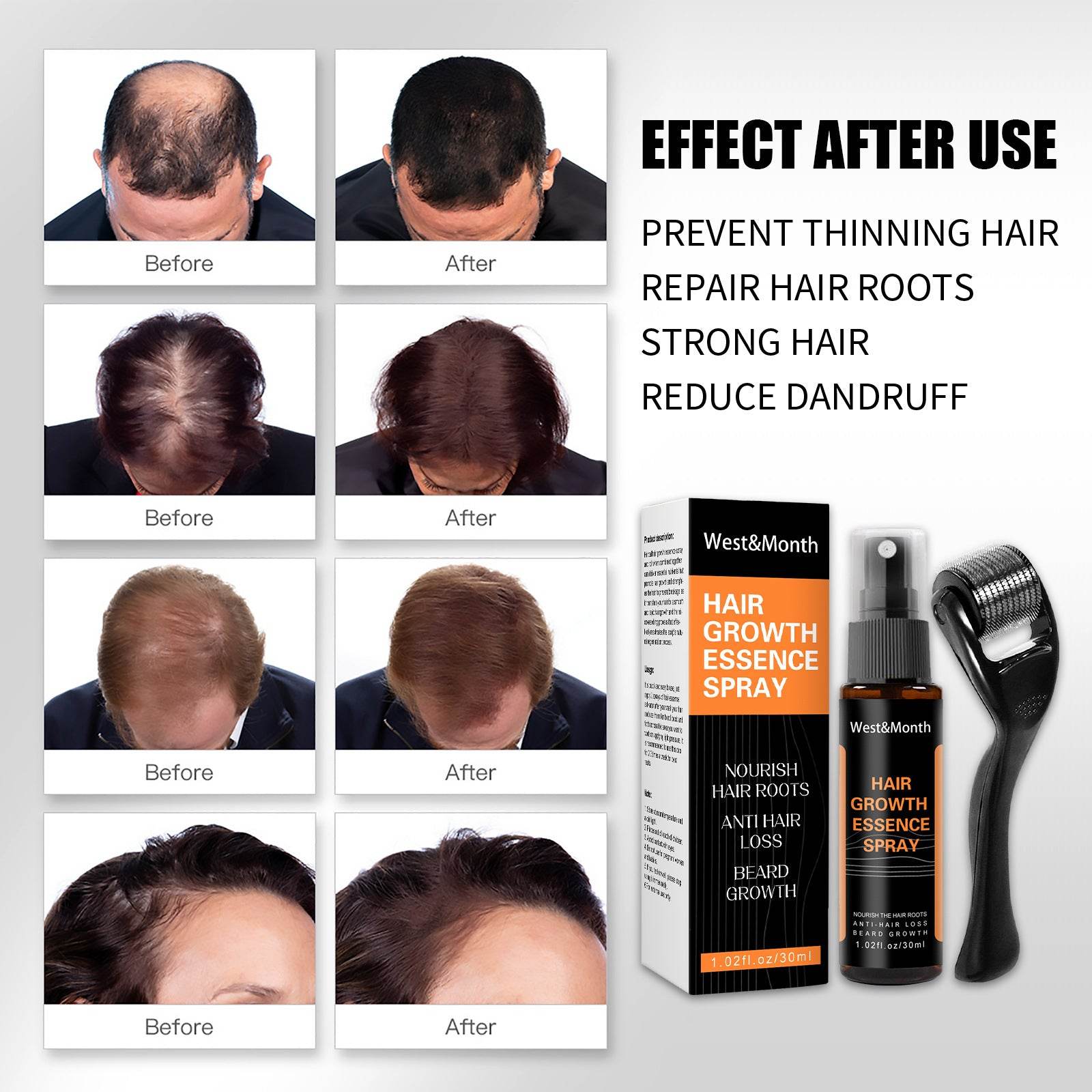 Hair Growth Spray Anti-hair Nourishing Growth Liquid - Mubimart