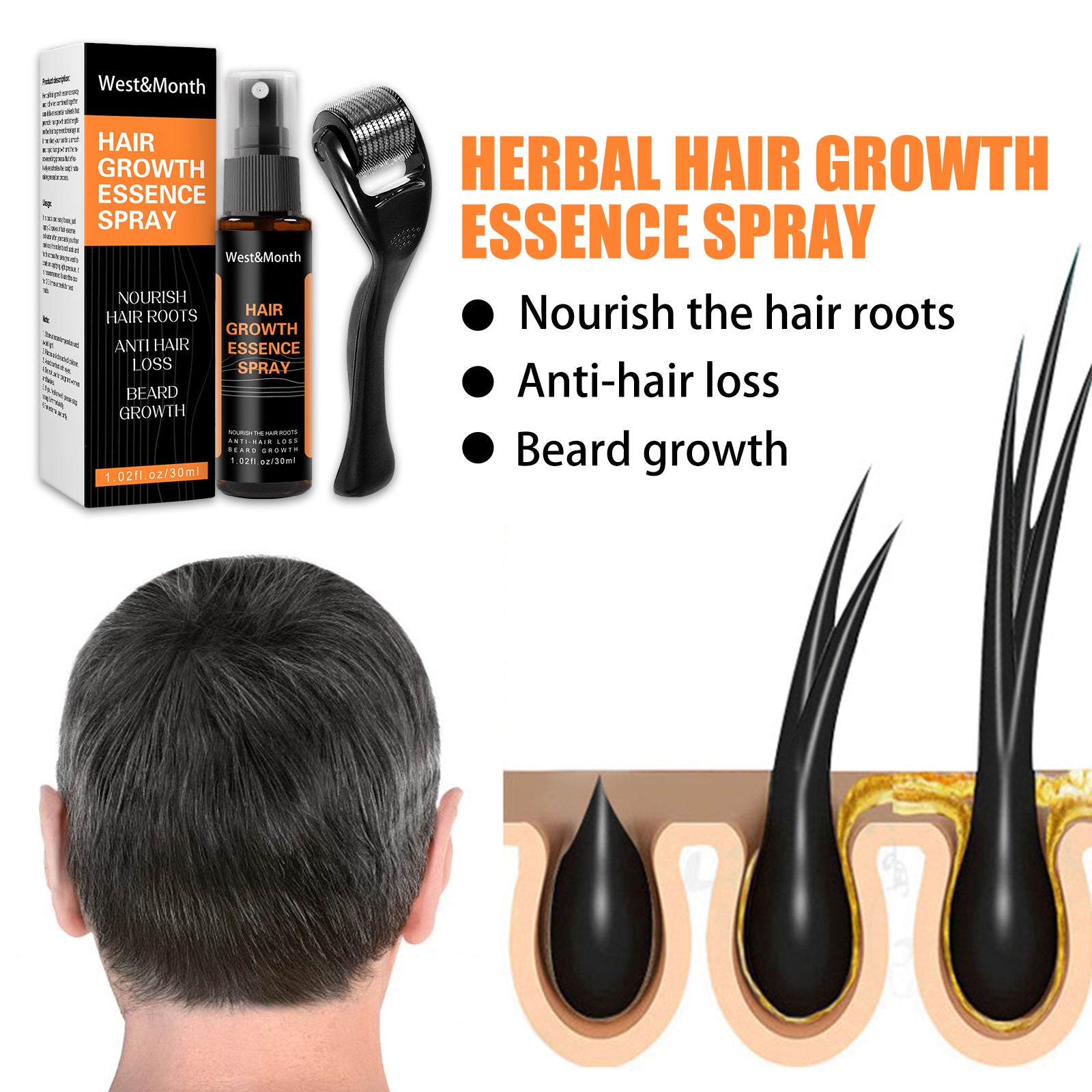 Hair Growth Spray Anti-hair Nourishing Growth Liquid - Mubimart -  