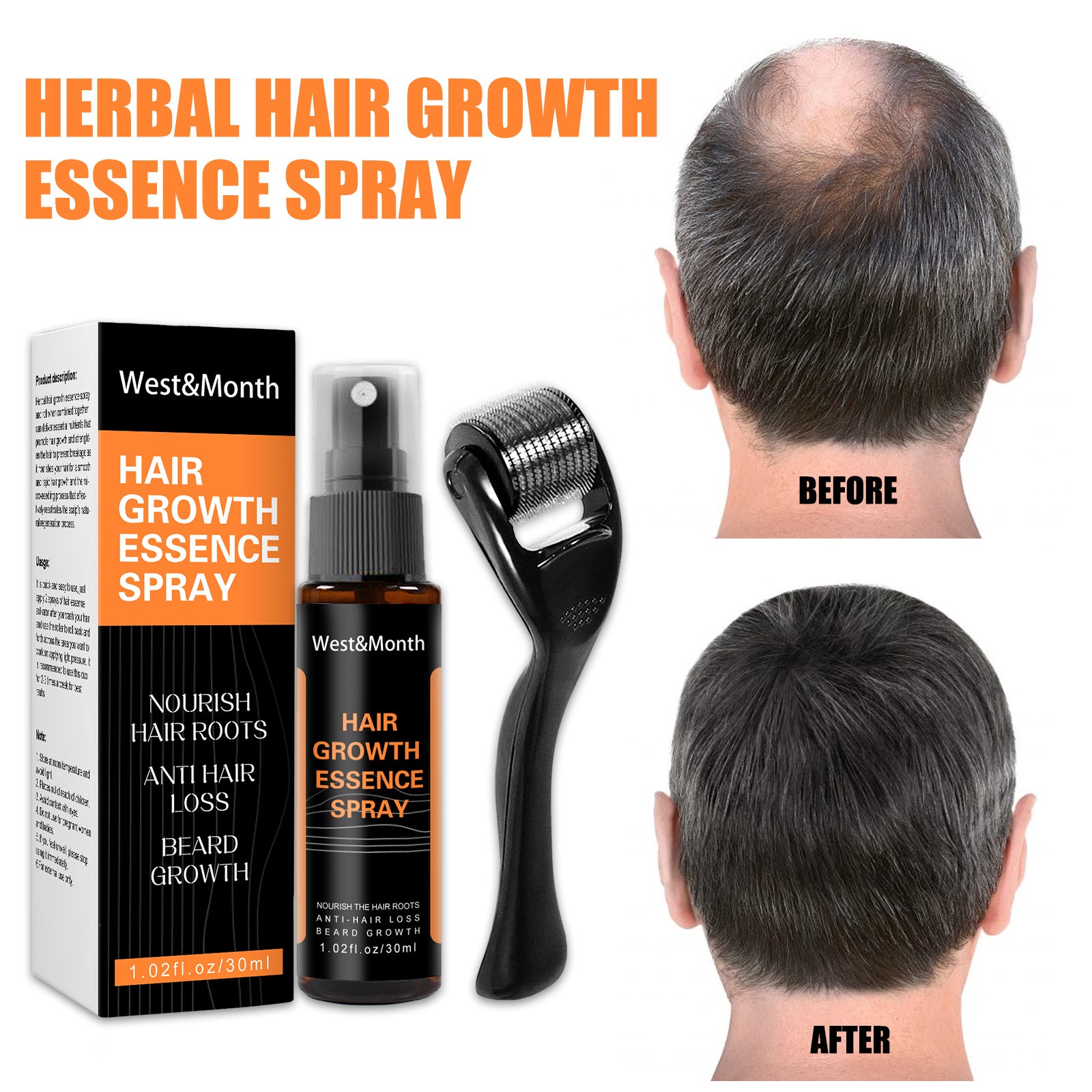 Hair Growth Spray Anti-hair Nourishing Growth Liquid - Mubimart - Hair Spary 