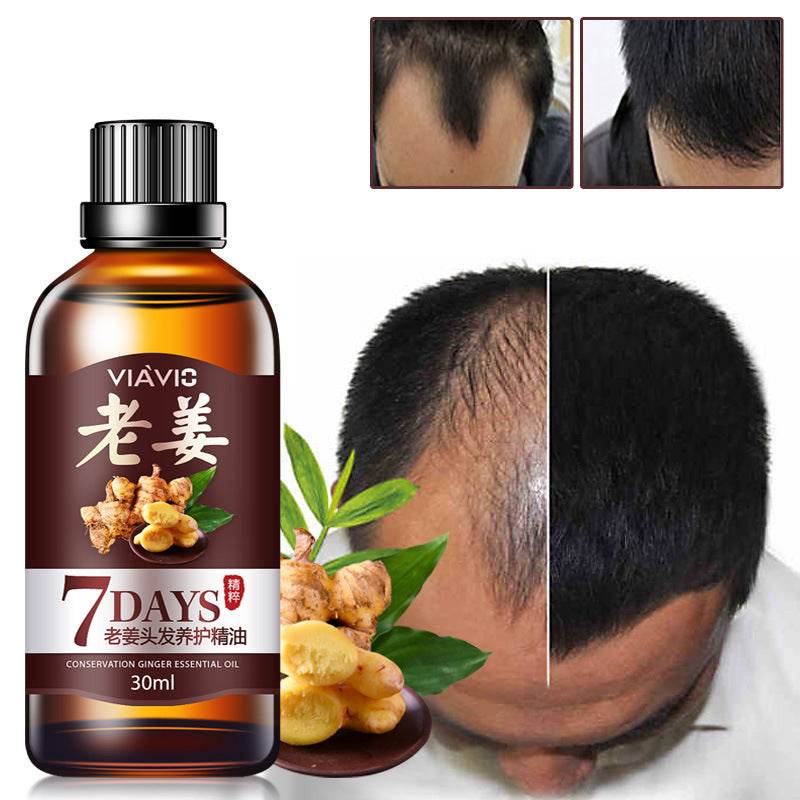 Hair Nutrient Liquid, Head Generation Liquid, Hair Care Essential Oil - Mubimart