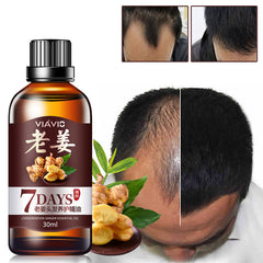 Hair Nutrient Liquid, Head Generation Liquid, Hair Care Essential Oil - Mubimart - Hair oil 