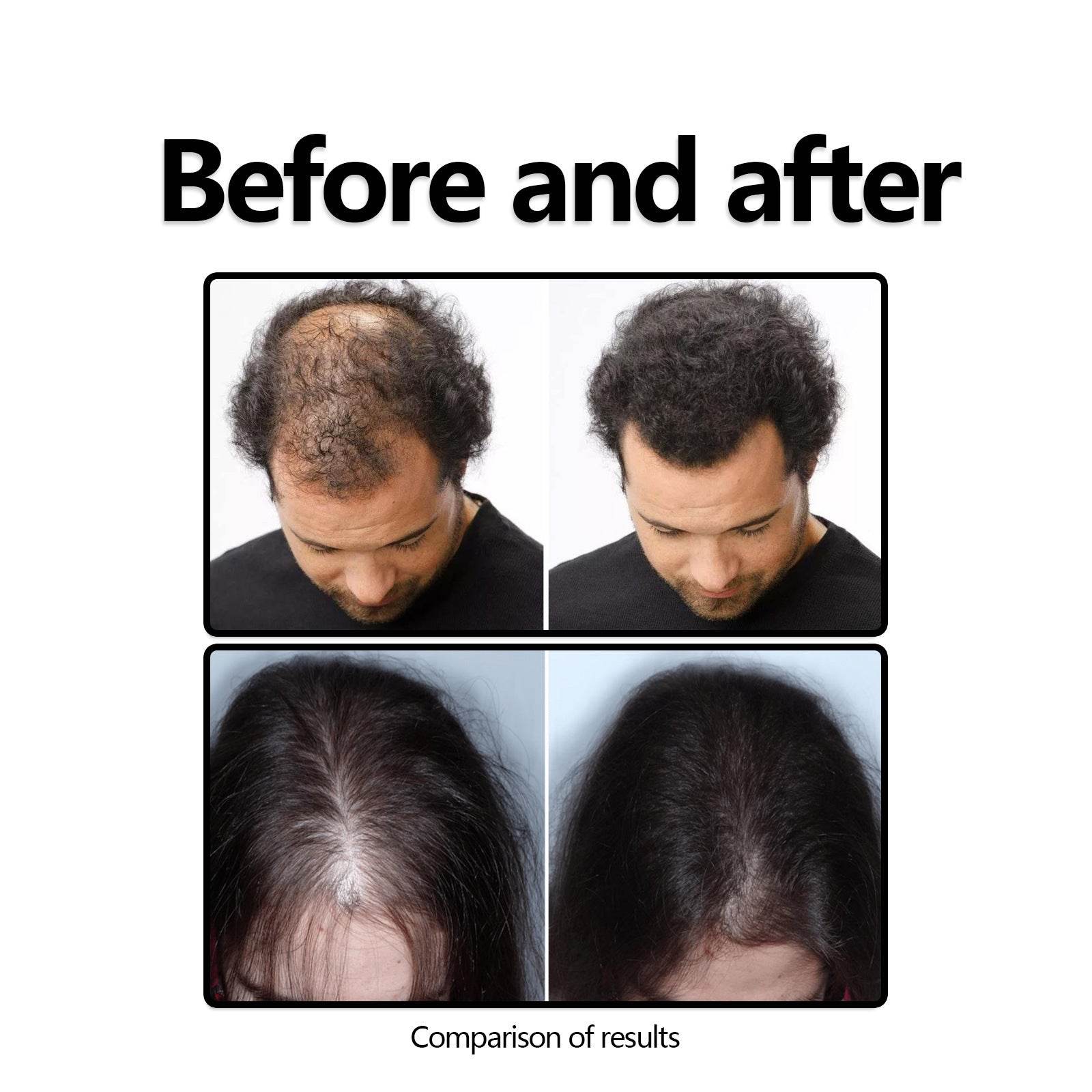 Herbal Hair Care Solution Anti-hair Loss And Strong - Mubimart
