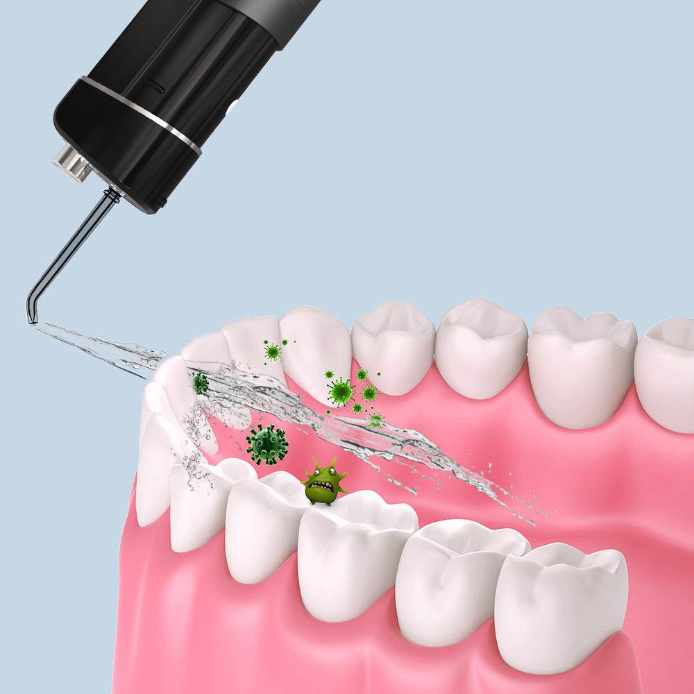 Home Calculus Pulse Orthodontic Water Flosser - Mubimart