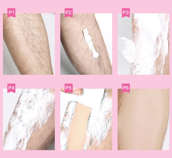 Humei Yichun Spring Hair Removal Cream - Mubimart -  