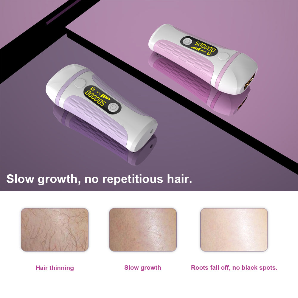 IPL laser hair remover - Mubimart -  