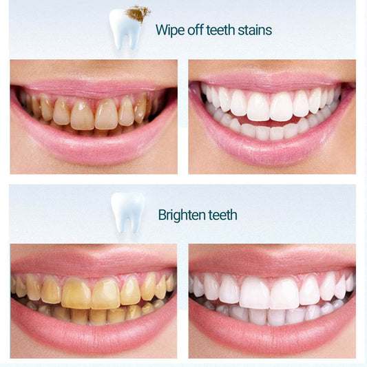 Lazy brightening toothpaste - Mubimart
