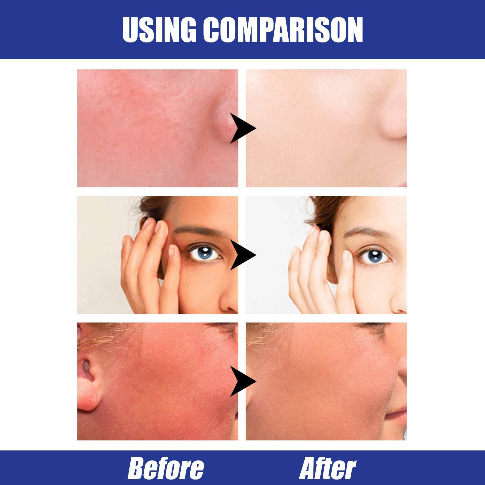 Lightweight Freshing And Moistrurizing Waterproof SPF50 Hyaluronic Acid Sun Block Stick - Mubimart