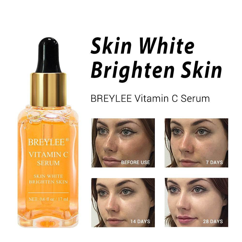 Lotion Moisturizing Facial Treatment - Mubimart