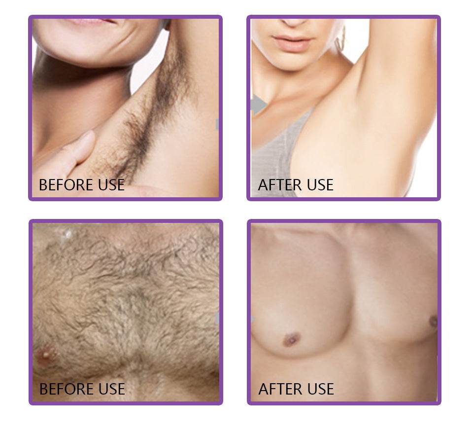 Mild and non-irritating hair removal cream - Mubimart