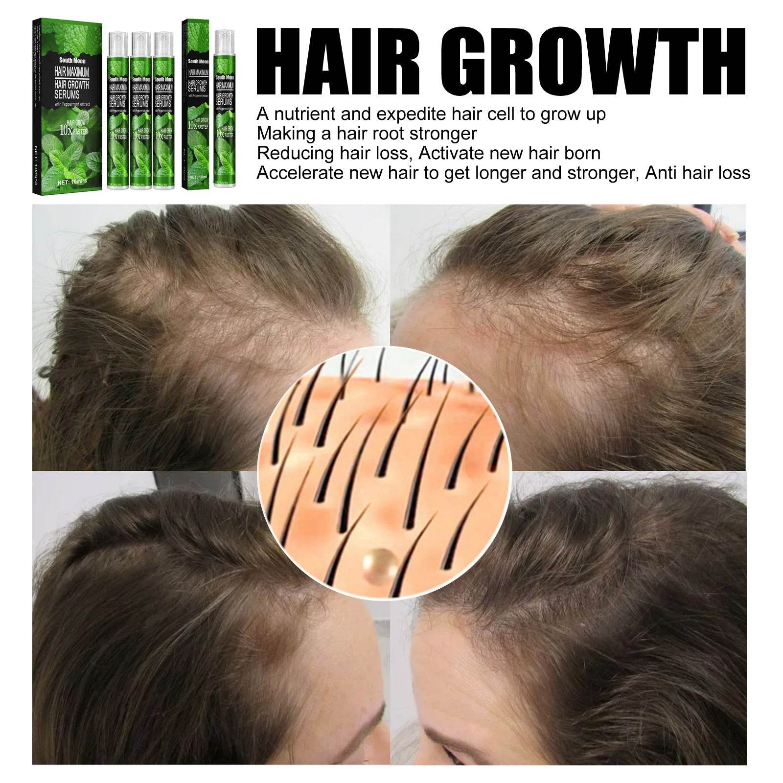 Mint Nutrition Nourishing Hair Growth Spray - Mubimart