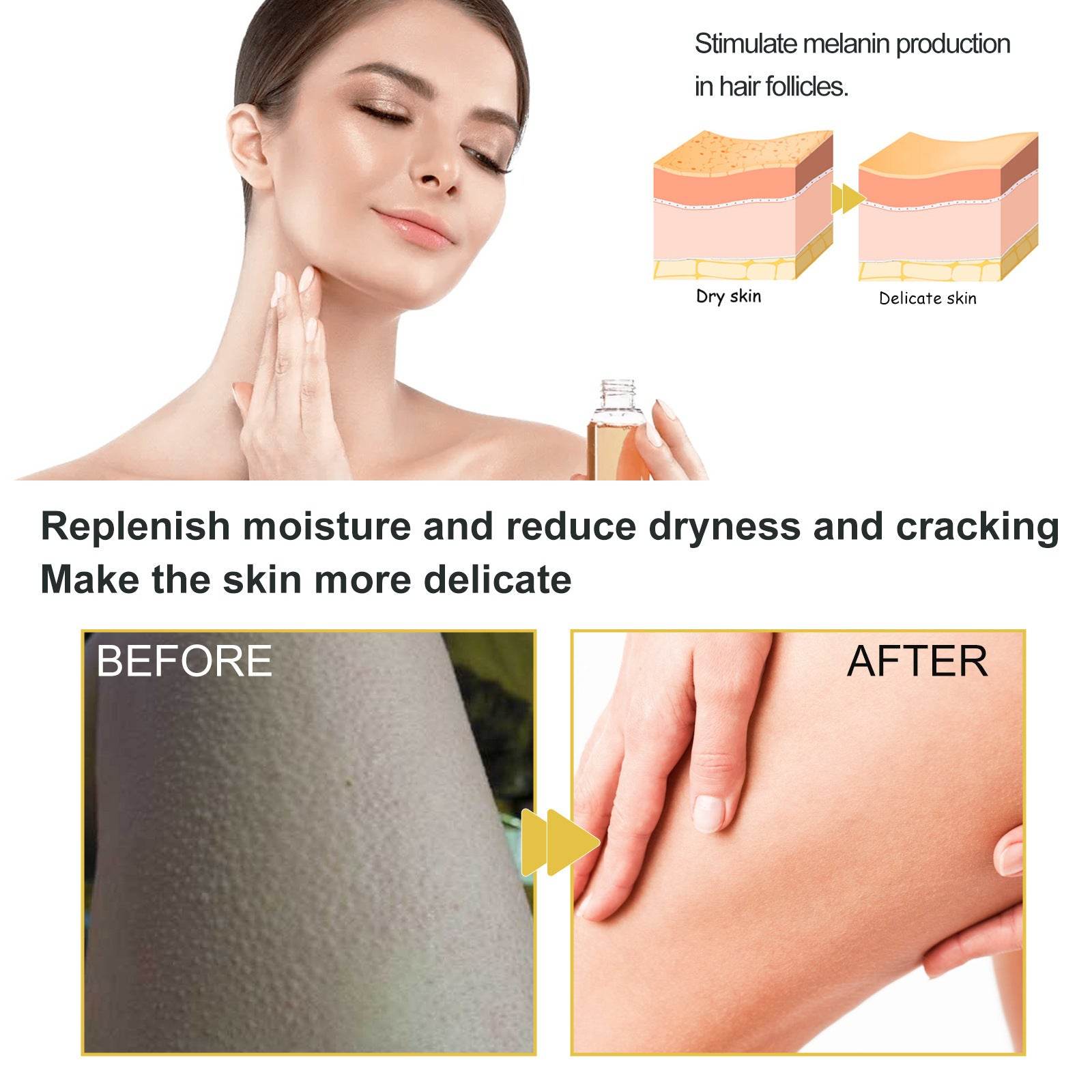 Moisturizing Body Oil Repair Dry Dead Skin - Mubimart