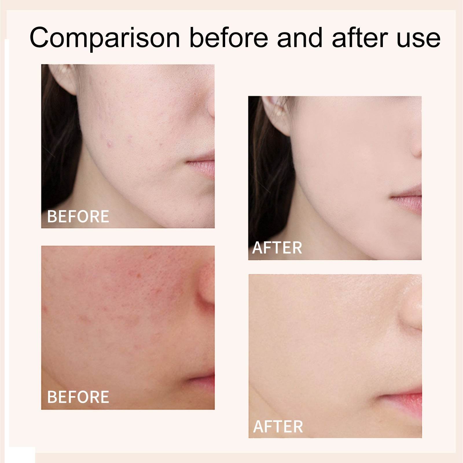 Moisturizing Skin Before Makeup Foundation - Mubimart