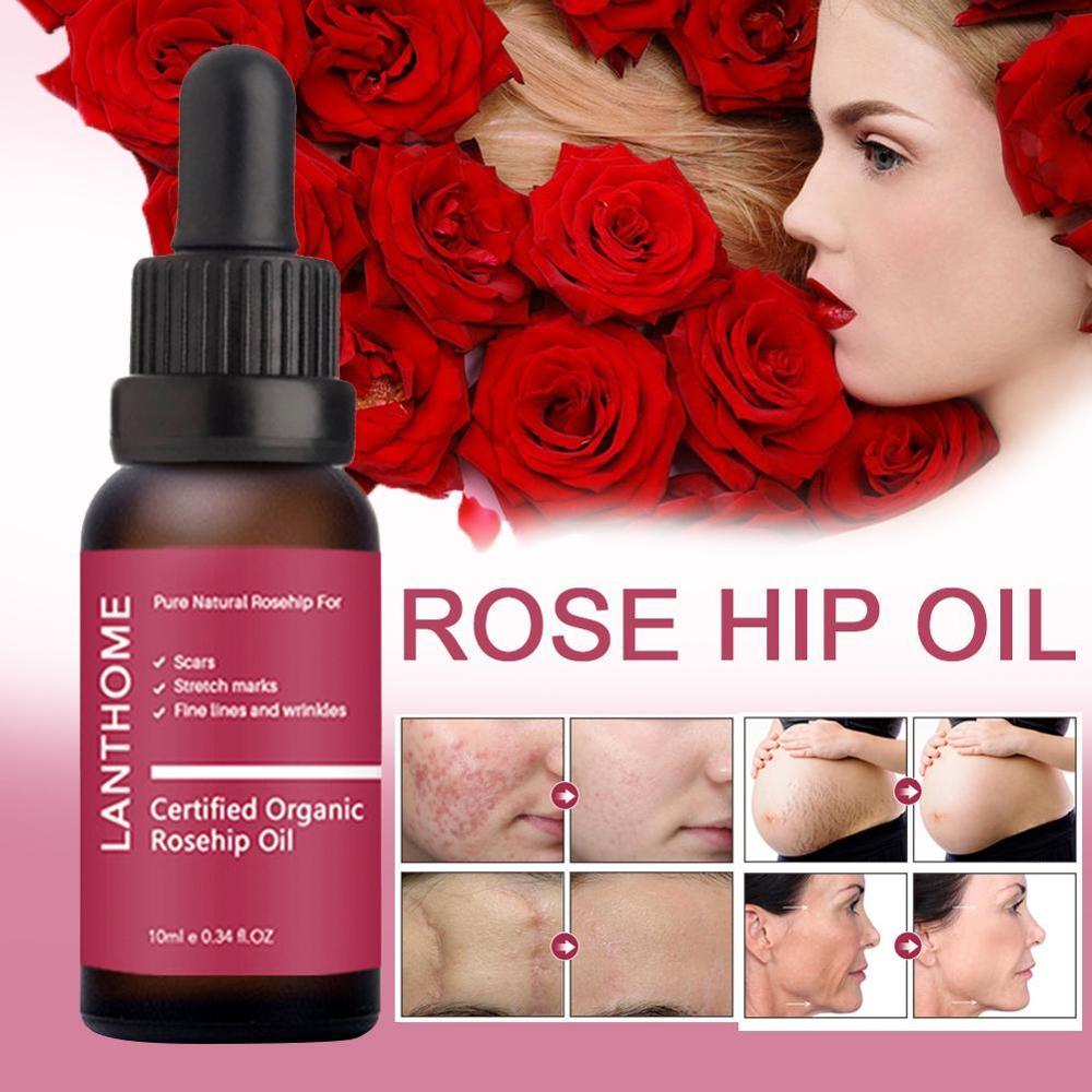 Moisturizing and moisturizing rosehip oil - Mubimart -  