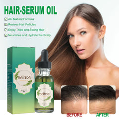 Nourishing Anti-hair Loss Thick Hair Care - Mubimart - Hair oil 