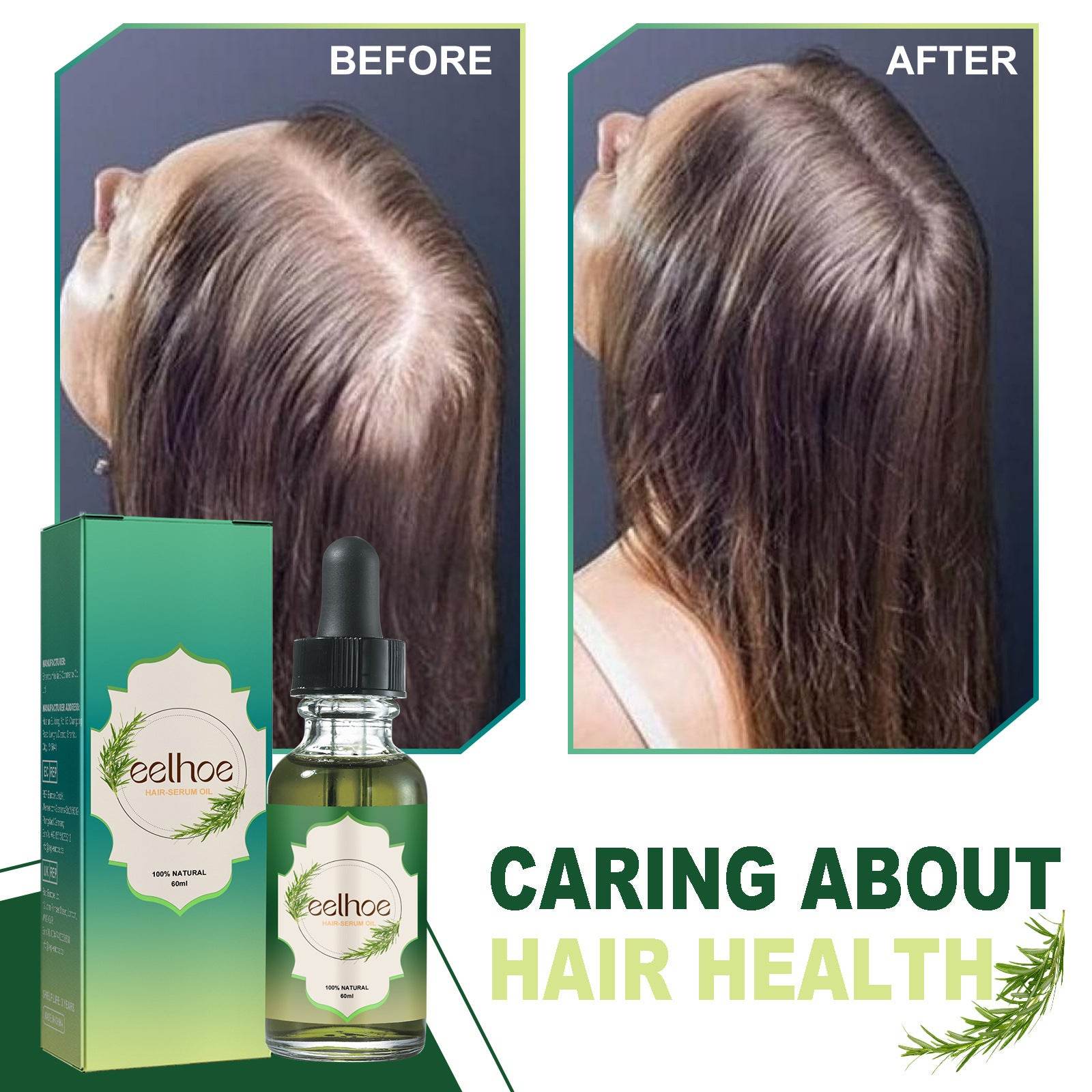 Nourishing Anti-hair Loss Thick Hair Care - Mubimart