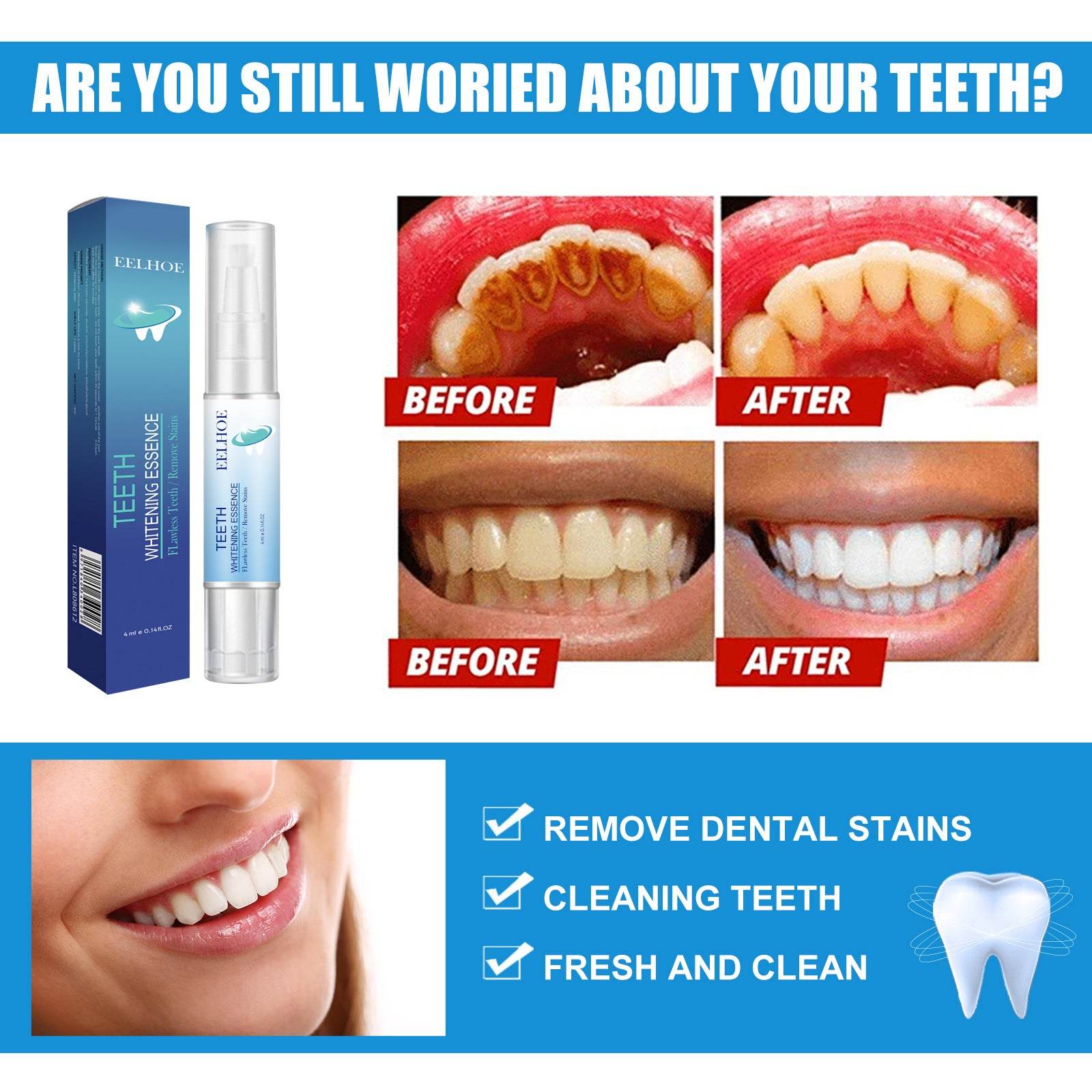 Oral Cleaning Dental Plaque Cleaning White Teeth Teeth Whitening Pen - Mubimart