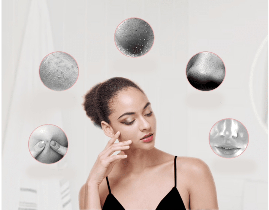 Silicone Facial Cleansing Instrument Electric Facial Cleansing Instrument Brush Facial Massage To Blackhead Pore Cleaner - Mubimart
