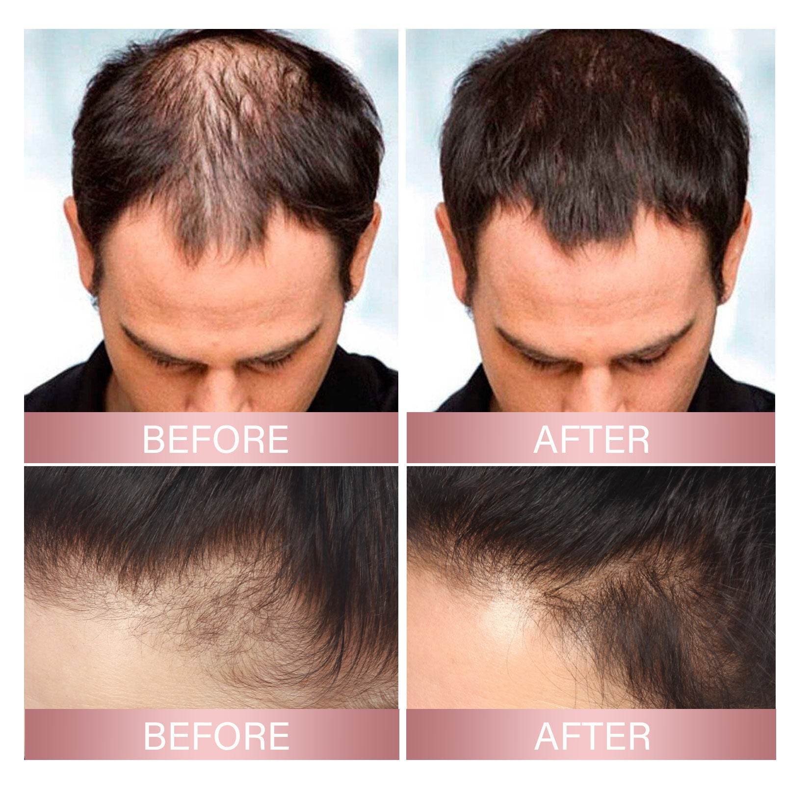 Strong Repair Rice Dense Hair Spray Hair Follicle Hair Root Anti-drop - Mubimart