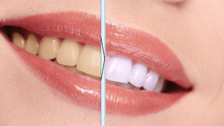 Teeth Whitening Pen Remove Plaque And Tartar Clean The Mouth Tooth Brushing - Mubimart