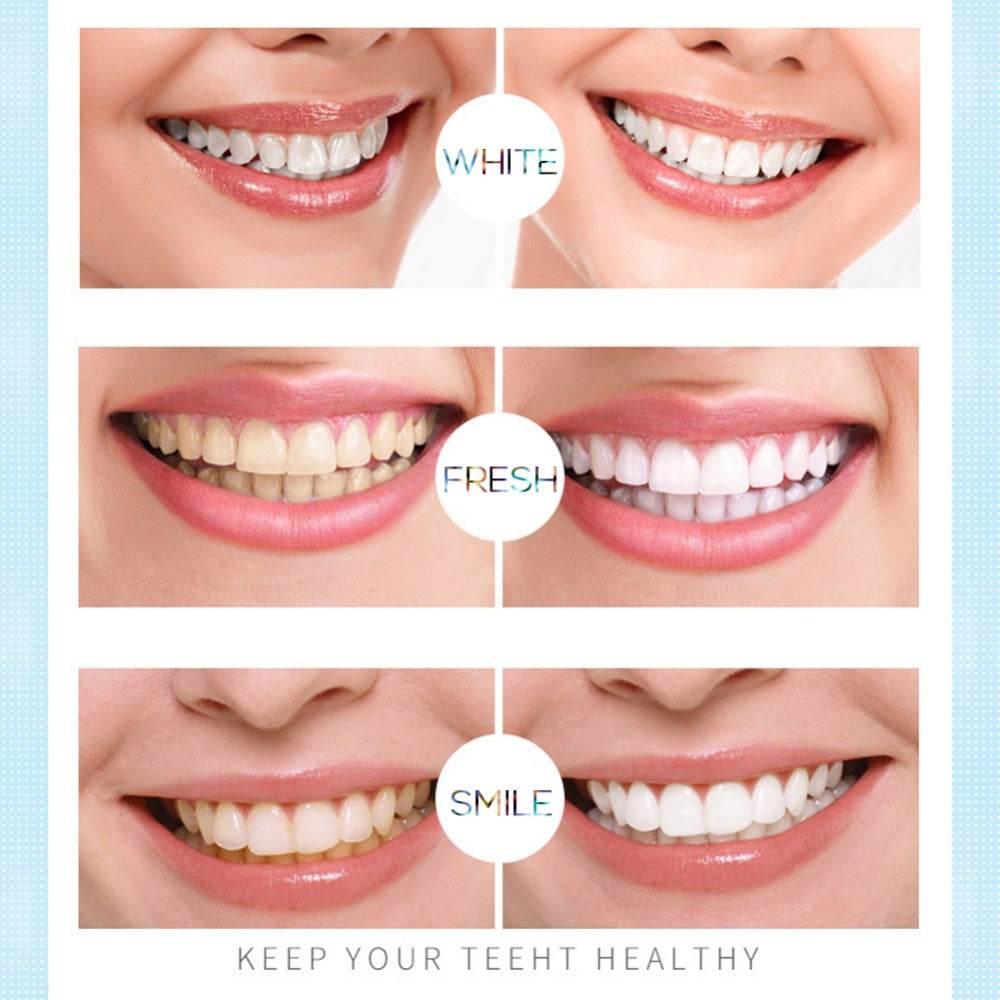 Teeth whitening pen - Mubimart