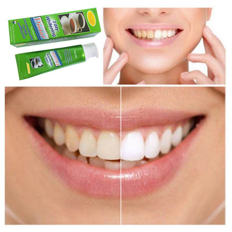 Toothpaste for tea stains - Mubimart