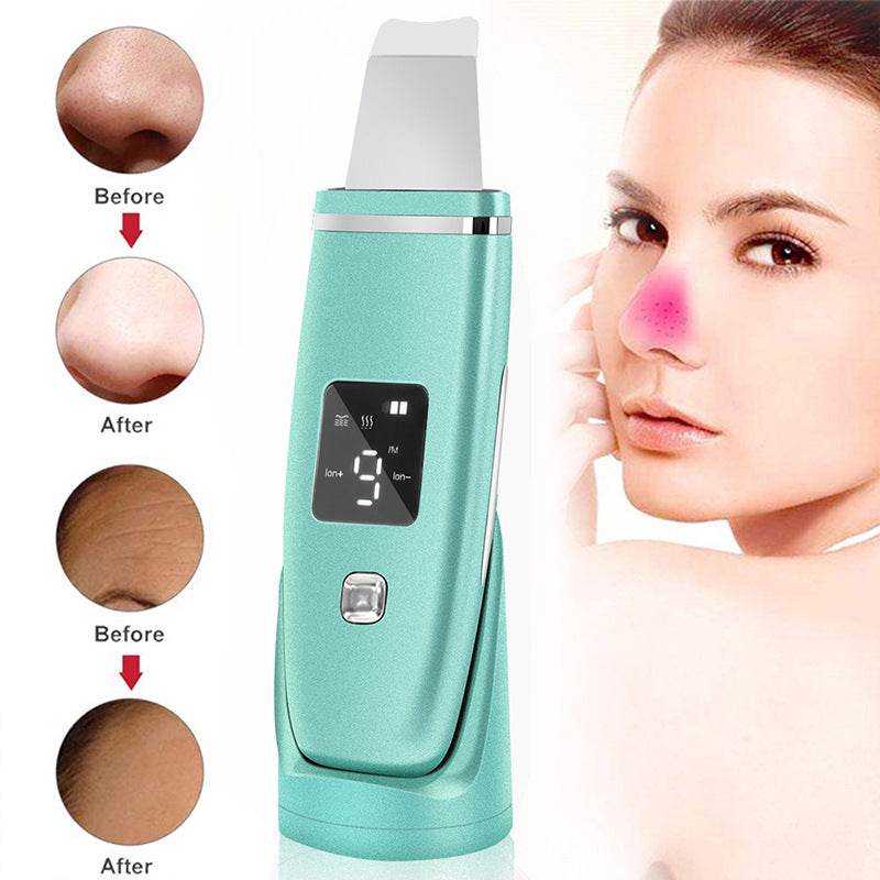 Ultrasonic Vibration Blackhead Remover Deep Cleansing Face Scrubber Pore Cleaner Lifting Machine Facial Led Peeling Shovel - Mubimart