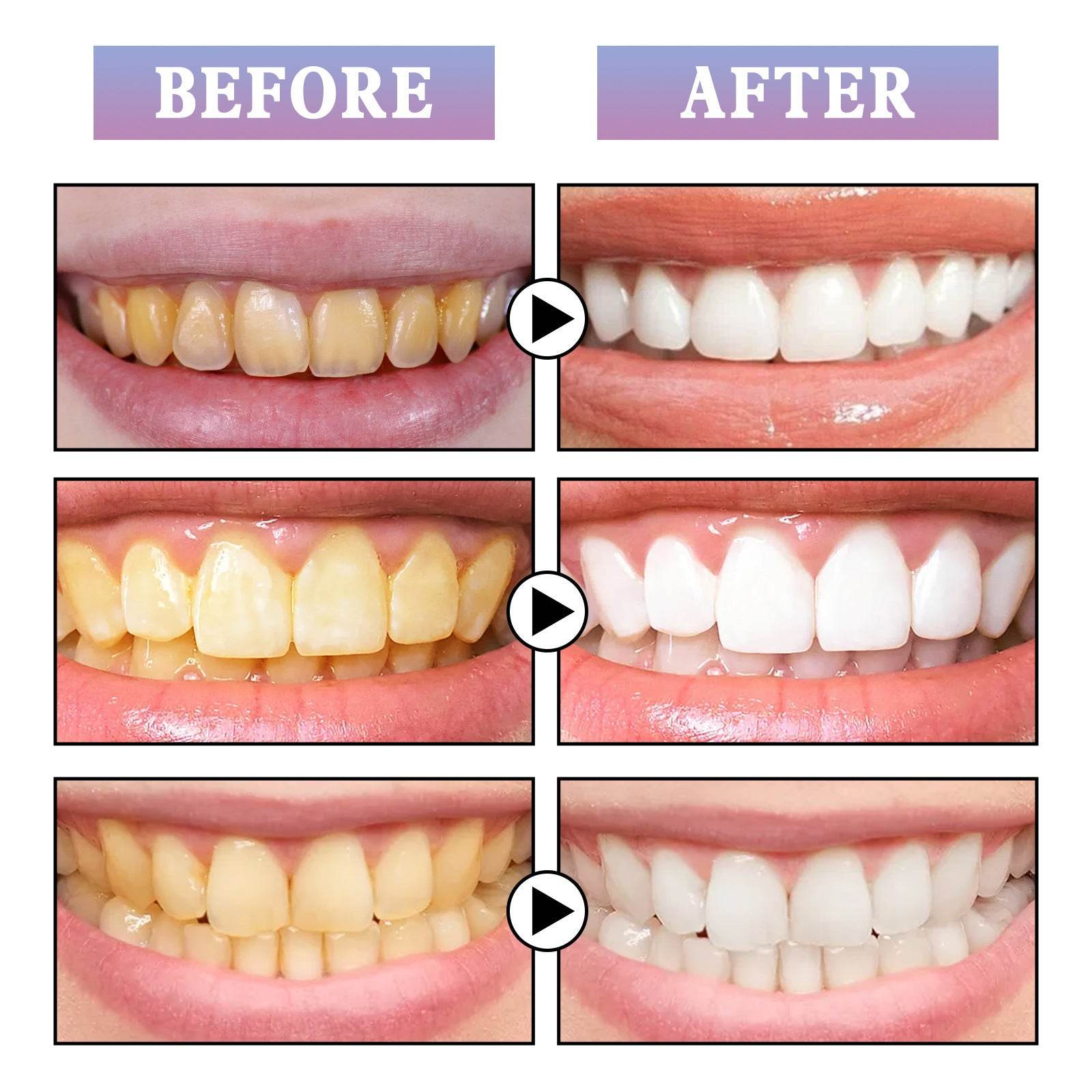 Whitening Toothbrush Pen Oral Care Cleaning - Mubimart