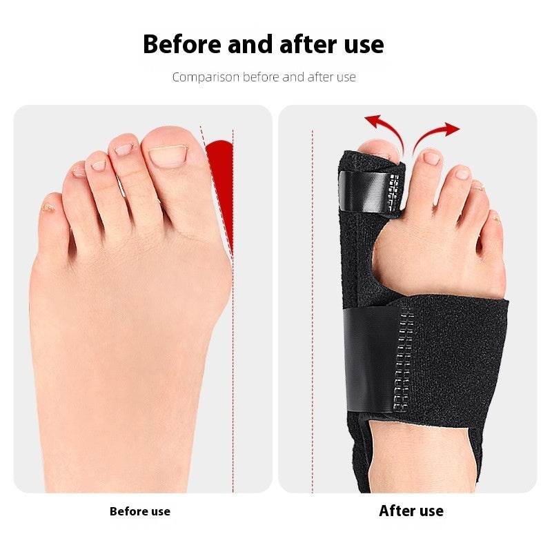 Thumb Hair Curler Hallux Valgus Toe Separator - Mubimart
